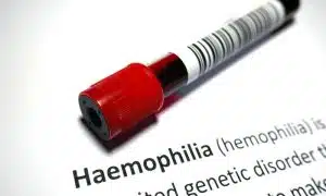 Tratamento para hemofilia unirá farmacêutica Bayer e poder público